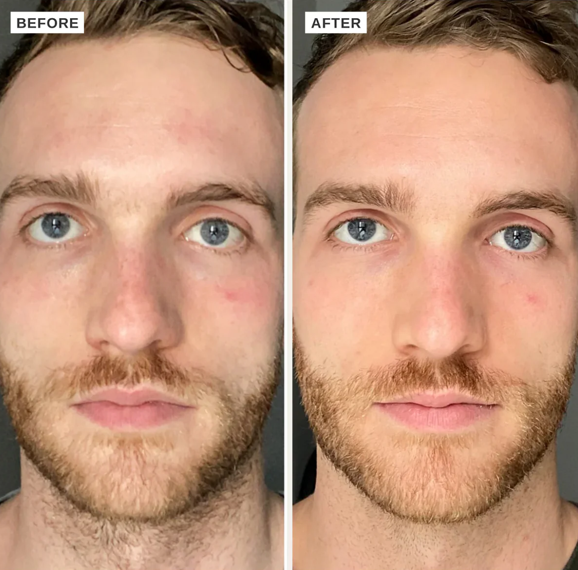 維他命B 精華 VITAMIN B SERUM 15ML/25ML （升級版）