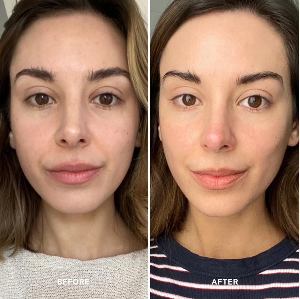 維他命C 精華 VITAMIN C SERUM 15ML/25ML （升級版）