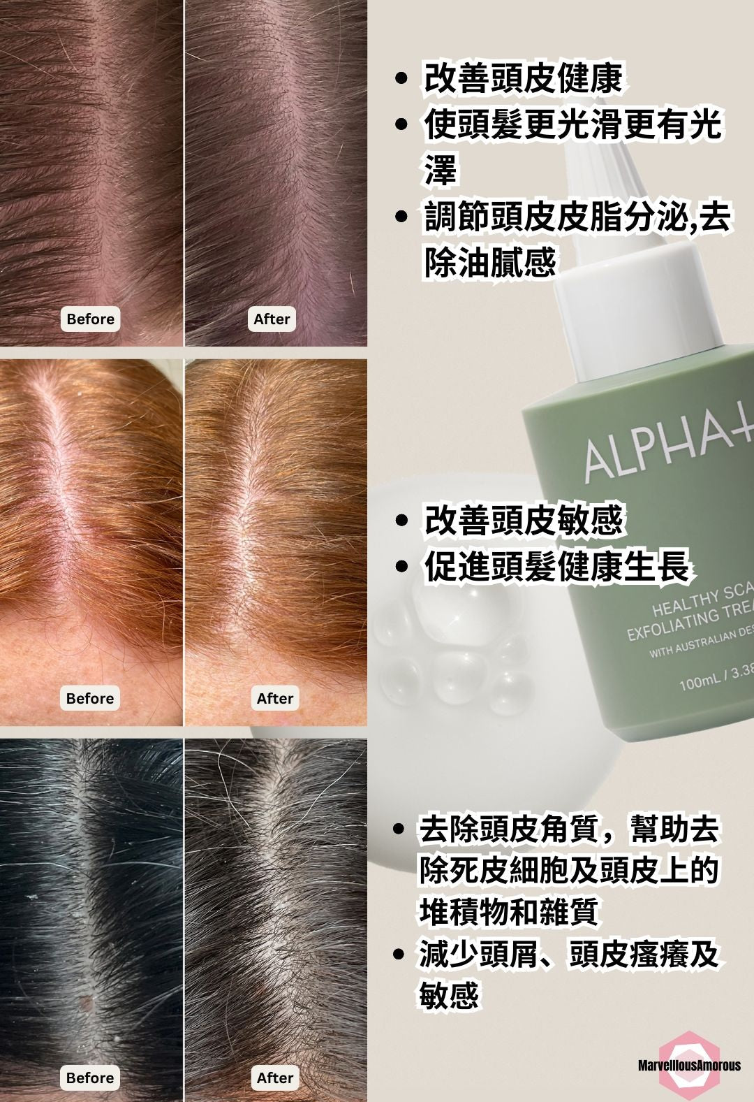 Healthy Scalp Exfoliating Treatment 去角質強健頭皮護理